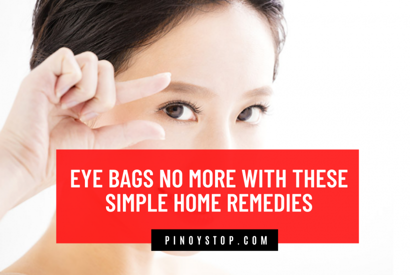 Eye Bags No More With These Simple Home Remedies